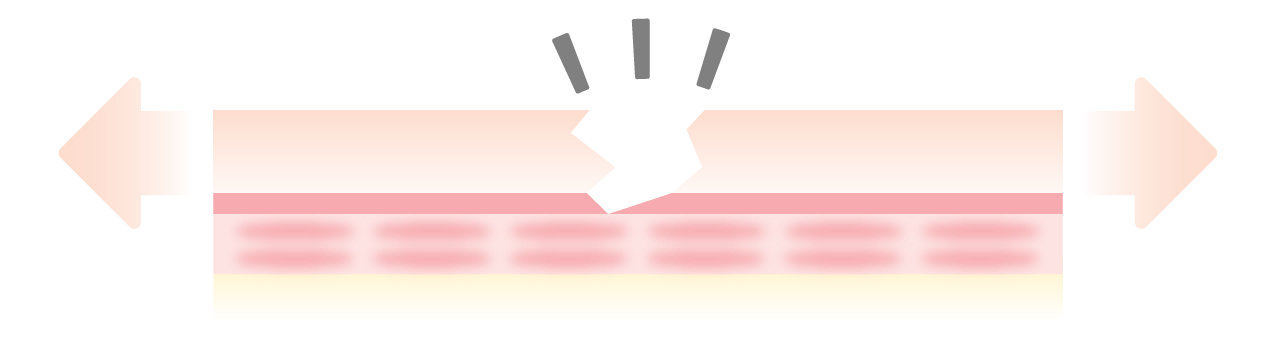 乾燥しやすいお肌